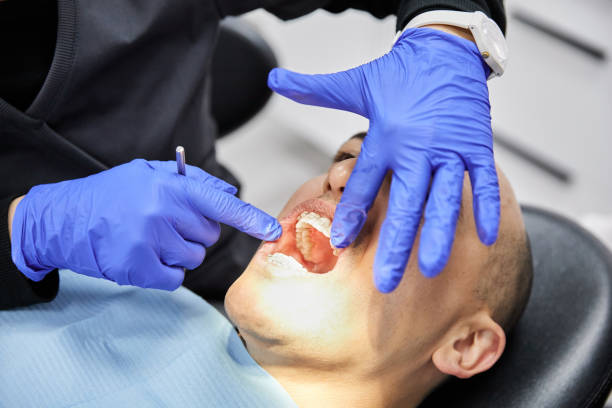 Best Broken Tooth Emergency  in Bermuda Dunes, CA