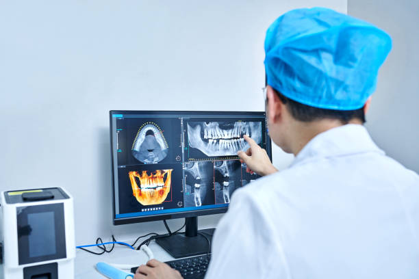 Emergency Dental Filling Replacement in CA